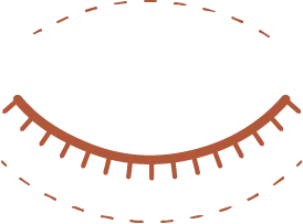 Evaluación de oculoplastia en Arenales